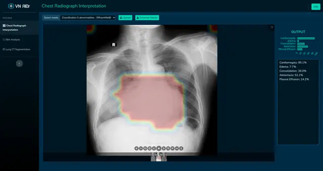 VN AIDr - Open source medical image processing